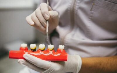 Tratamientos para eliminar sarro